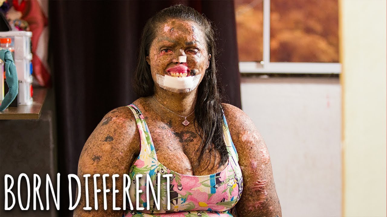 My Skin Condition Hasn