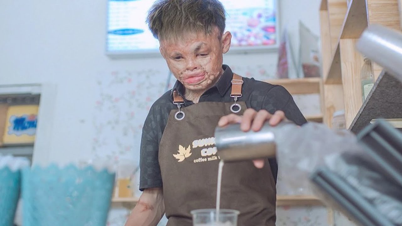 Boy with facial deformities chasing his dream