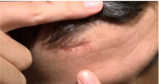 He went to the hospital since he had a headache for a few days.