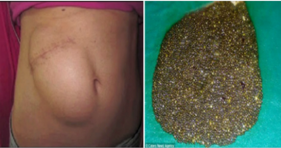 The woman who arrived at the emergency room with a terrible stomach ache