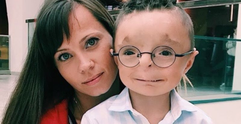 Kind-hearted woman adopted a boy, that no one wanted to adopt: see what he looks like now.