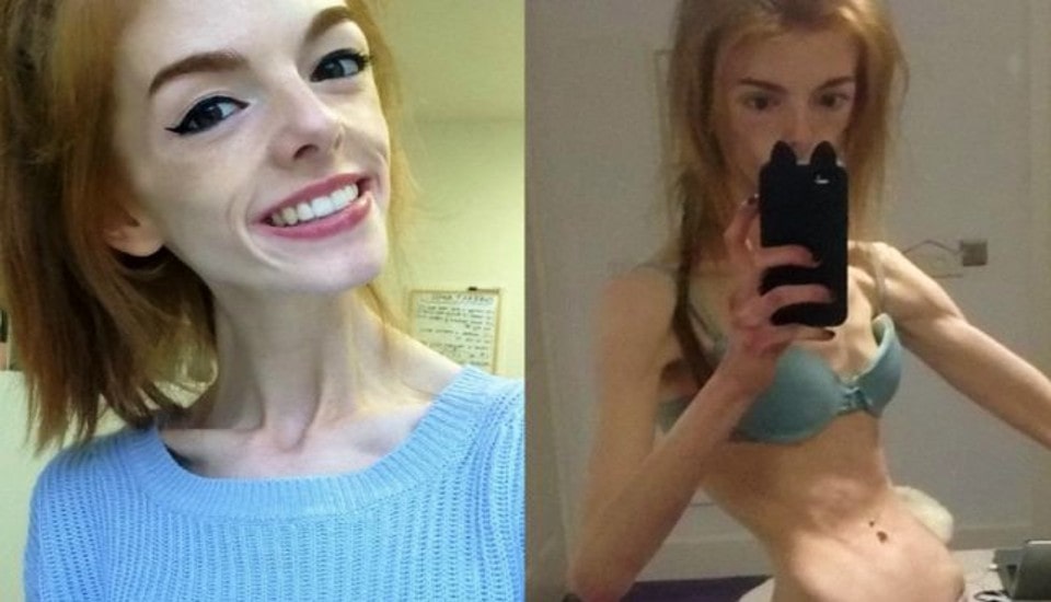 This is how a woman who has only eaten one piece of bread a day for 5 years looks like!