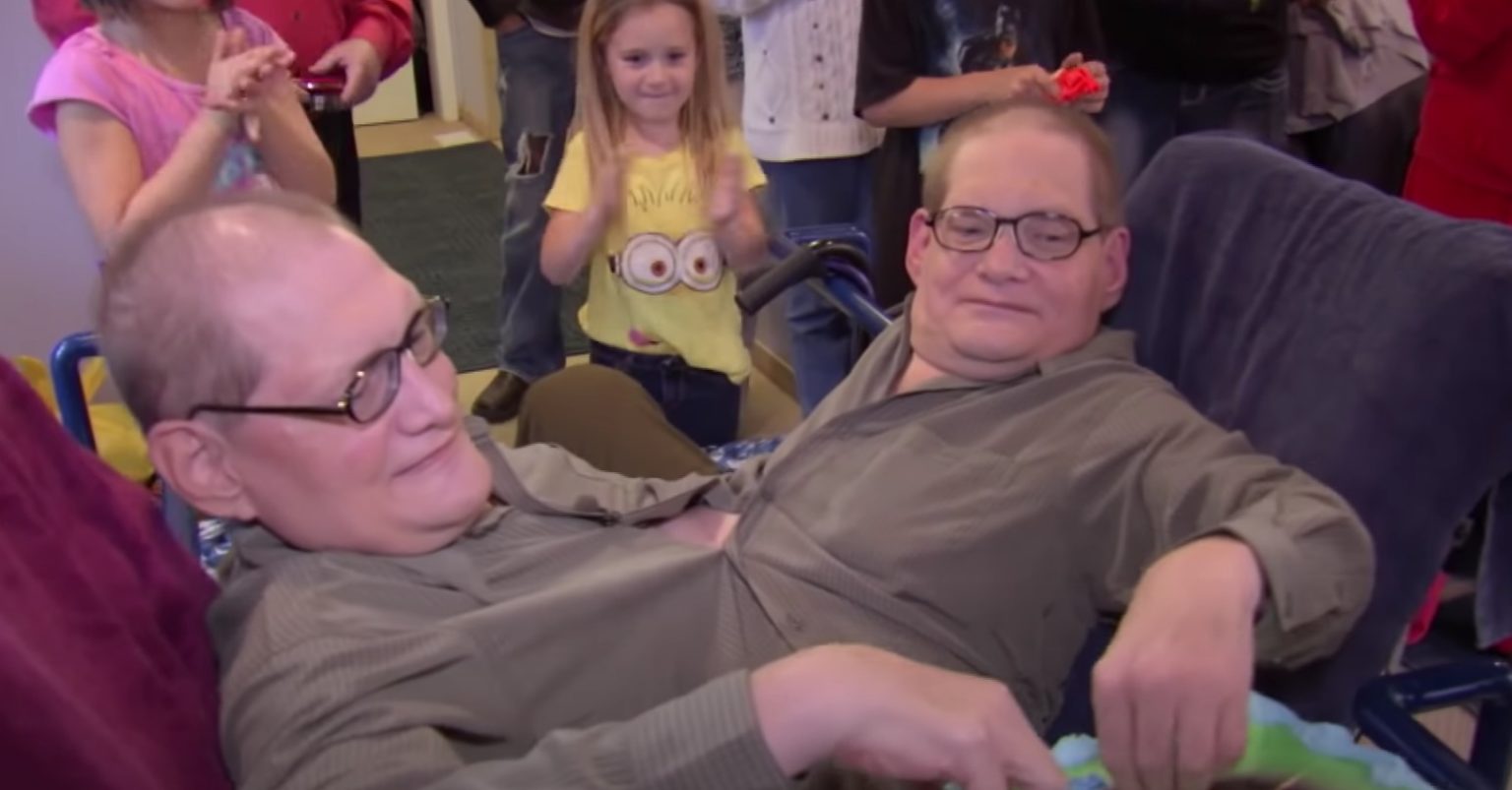 Remembering Ronnie and Donnie The World’s Oldest Conjoined Twins Who