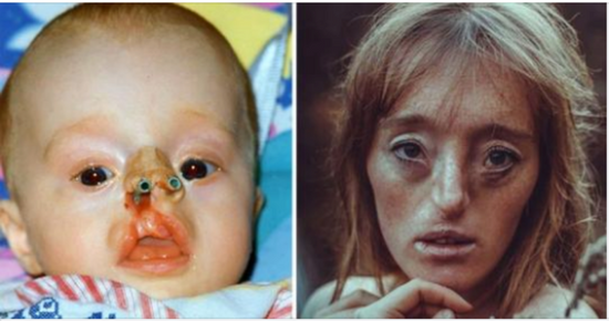 Young girl was born with rare facial defect – now she’s breaking beauty standards with her modelling career