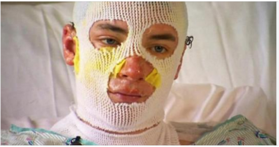 Heroic uncle runs into burning house to save 8-year-old niece after saving nephews