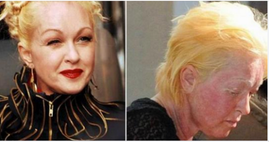 Sad news about the beloved singer Cyndi Lauper
