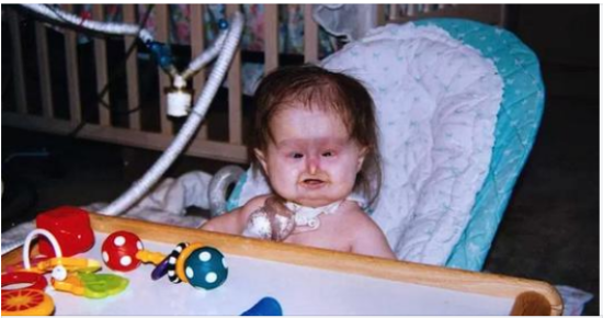 Mom notices something’s wrong when giving birth – 22 years later her baby daughter is still mistaken for a child