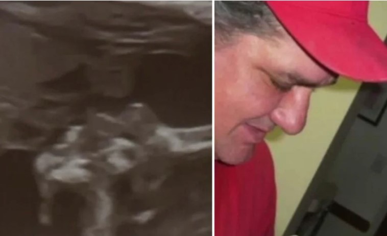 Pregnant Woman Sees An Angel Kissing Her Unborn Child In Sonogram