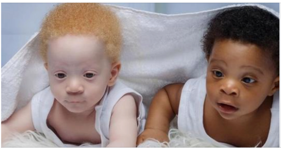 Mom Of Black And White Twins Often Gets Asked Which One Of The Boys Is Hers