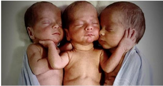 Mother Rushes To Emergency Room Delivers Triplets: Then Nurses Look Closer At Their Faces And Freeze