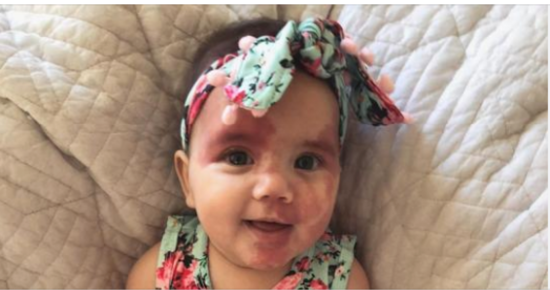 Baby called ‘hideous’ is a gorgeous grown-up little girl now