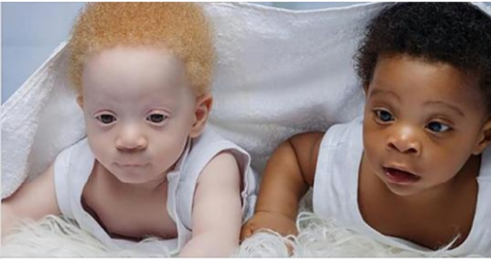 Mom of black and white twins always gets asked which one of the boys is hers