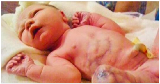 Mom Delivers Baby, Forbidden From Holding Him Because Something Was Wrong…