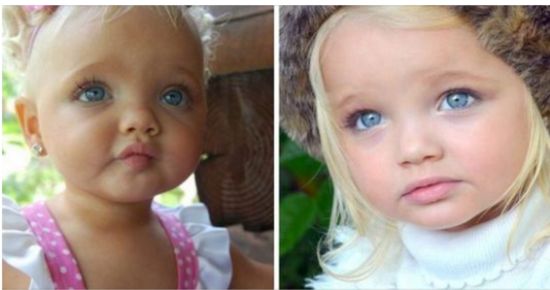 She Was Called A Real-Life Doll When She Was Just 2 Years Old, But Wait Till You See How She Looks Today