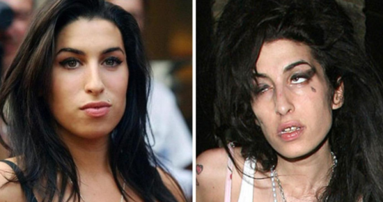 Amy Winehouse: The Before and After of Drugs and Alcohol