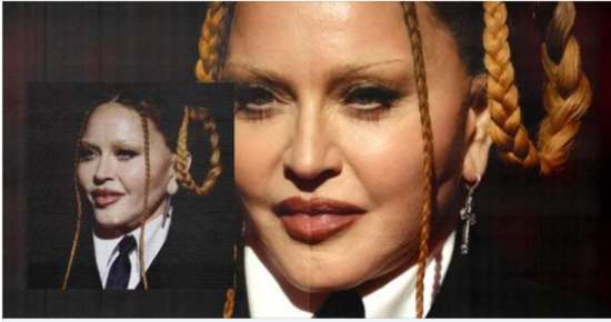 Fans express concern over Madonna – but why are people still commenting on women’s looks?