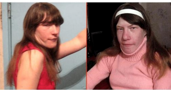No one believed that she would find a man and get married, but she shared her wedding photos and surprised everyone