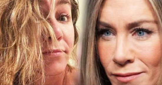Jennifer Aniston opens up about her plastic surgery, says she’ll never inject “s**t into my face”