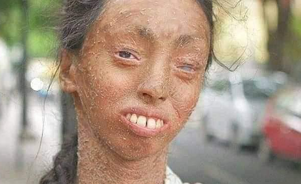 The Girl Whose Skin Peels Off | BORN DIFFERENT