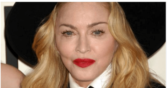Madonna Looks ‘Unrecognizable’ Now—A Plastic Surgeon Weighs In