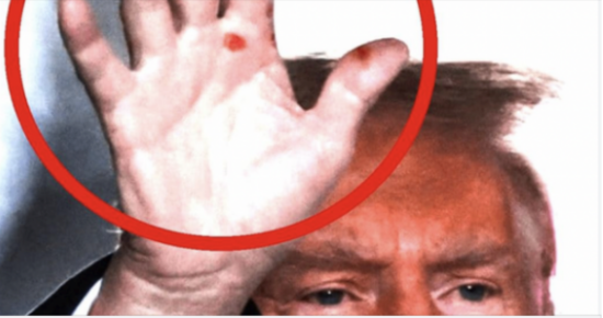 Former President Trump’s Health Raises Concerns