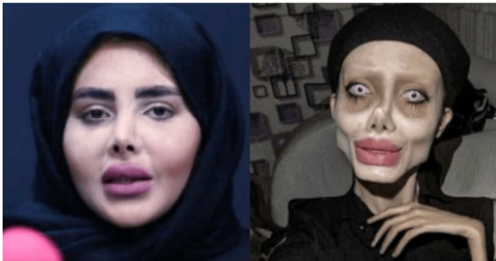 Sahar Tabar: A Controversial Transformation 