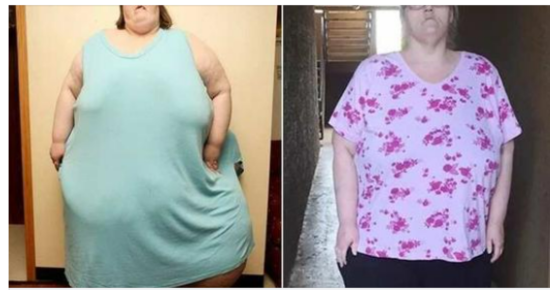 The Inspiring Transformation of Charity Pierce: Shedding 763 Pounds