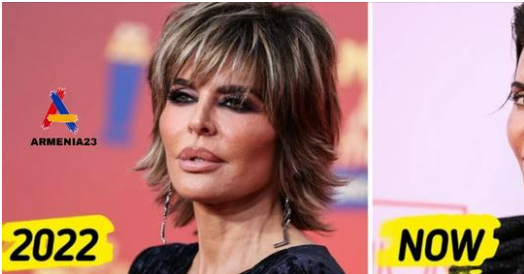 Fans Are Surprised by Lisa Rinna’s Latest Appearance, Calling It ‘She Ruined Her Face’