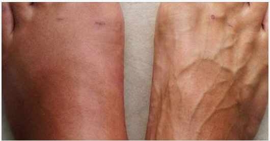 One Month Before A Heart Att.ack, Your Body Will Warn You Of These 7 Signs.