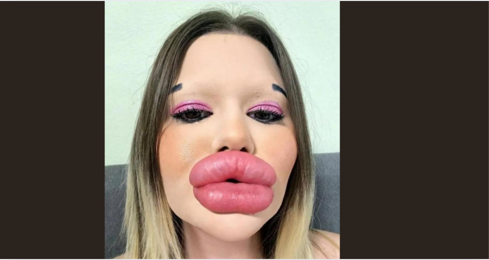 The individual boasting the largest lips on the planet! 