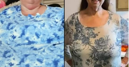 The world’s heaviest woman is no longer recognizable.