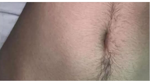 10 Signs Showing Something Is Wrong in Your Body 