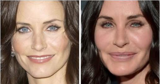 Well-known Stars Who Spent Millions Changing Their Looks