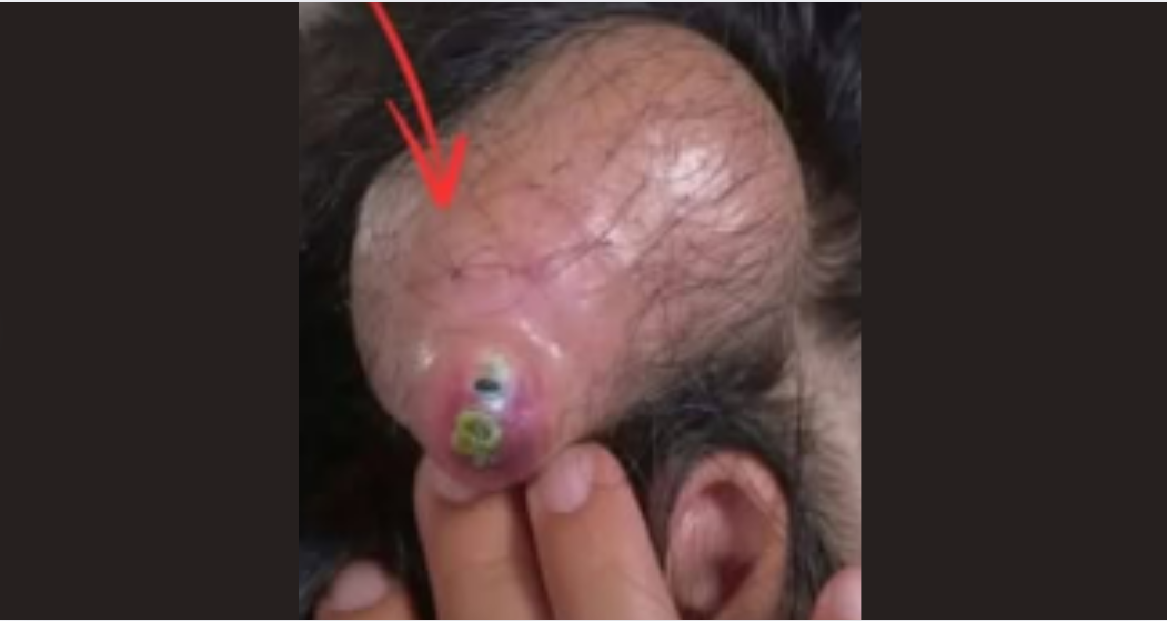 Tracking the Healing Journey of a