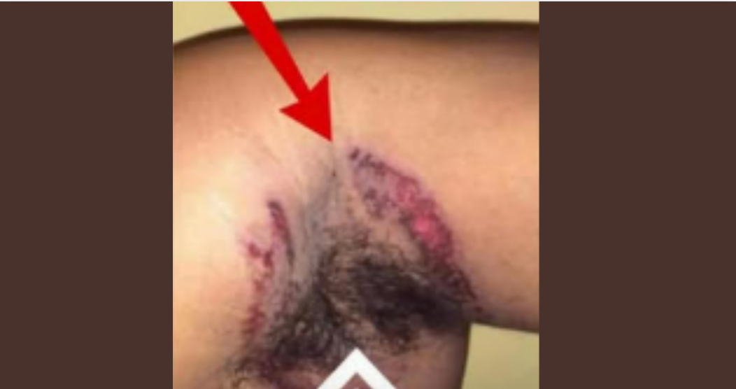 What Causes this..
