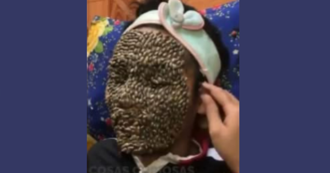 BEWARE OF THE BEES! MAN COVERS HIS FACE WITH 60,000 STINGING INSECTS AND SAYS THEY ONLY GIVE HIM “PLAYFUL BITES.”
