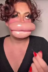 The woman with the “world’s biggest lips” has a new mission