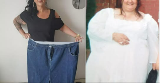 Mum Who Lost 16½ Stone Told to Gain Weight to Qualify for NHS Excess-Skin Surgery