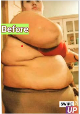 Lexi Reed’s Remarkable Comeback: From 485 Pounds and a Rare Disease to Swimsuit Confidence