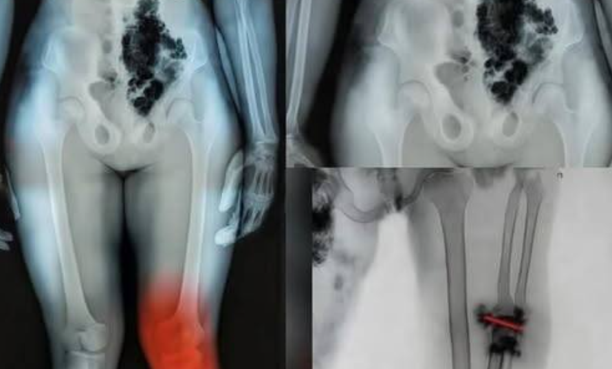 Global alert this will happen to them too.