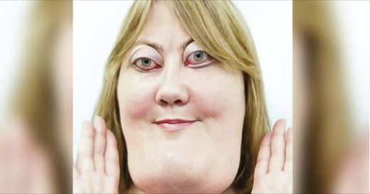 The incredible story of Victoria Wright: She inspires millions with her rare genetic condition