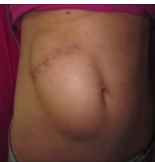 She went to the emergency room with a horrible stomach pain