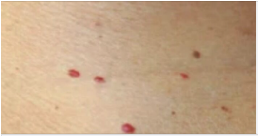 Red dots on your skin: Causes and what they could mean
