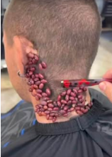 What Doctors Found Growing On The Back Of His Head Left Everyone Speechless