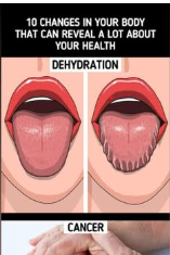 10 Symptoms That May Reveal Health Problems